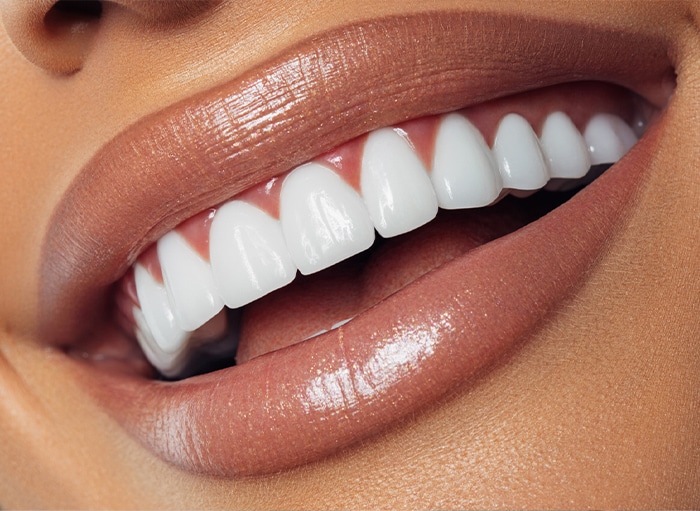 A woman with white teeth