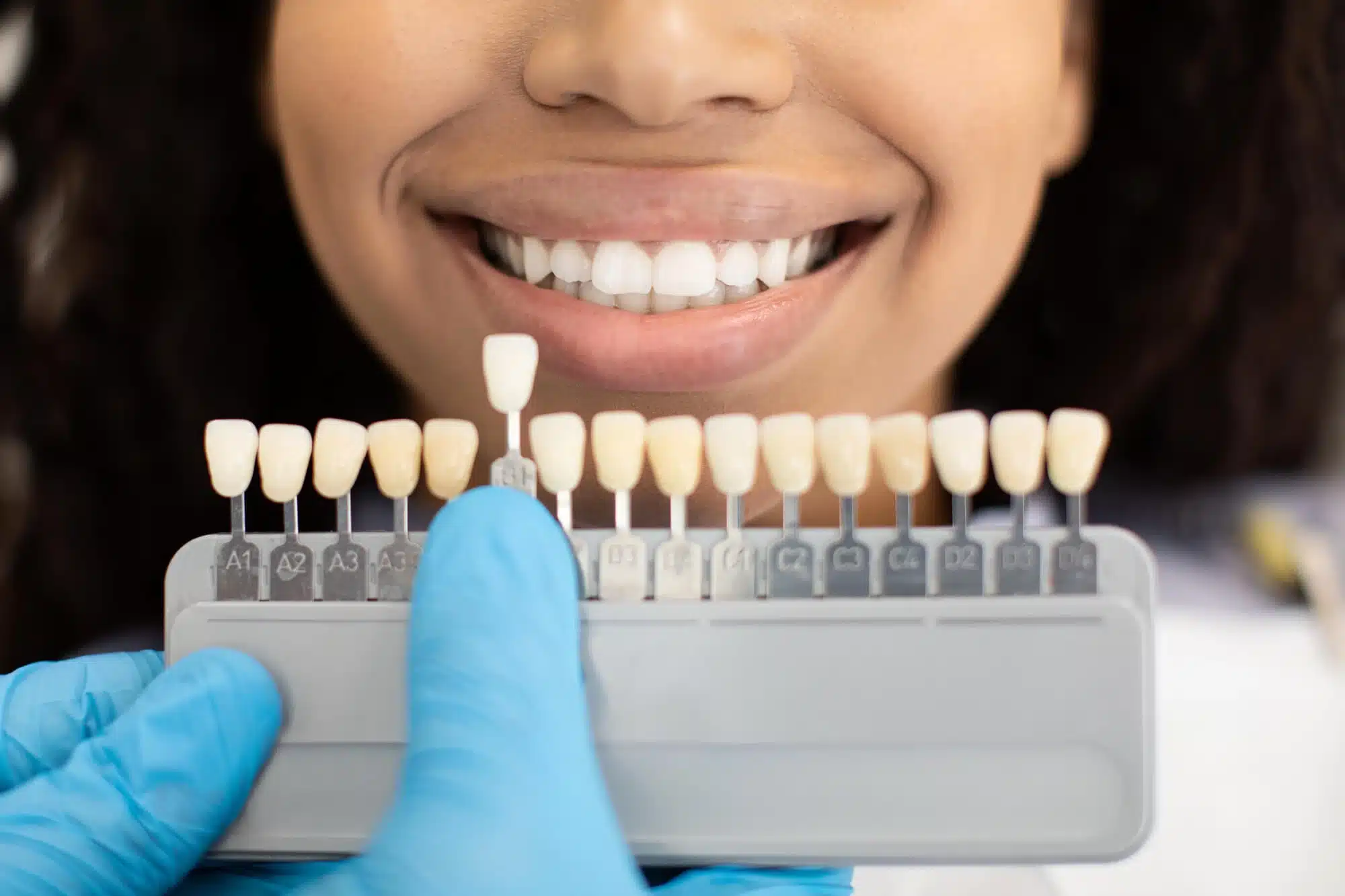 Dentist Matching Tooth Shade for Veneers in Riverview, MI
