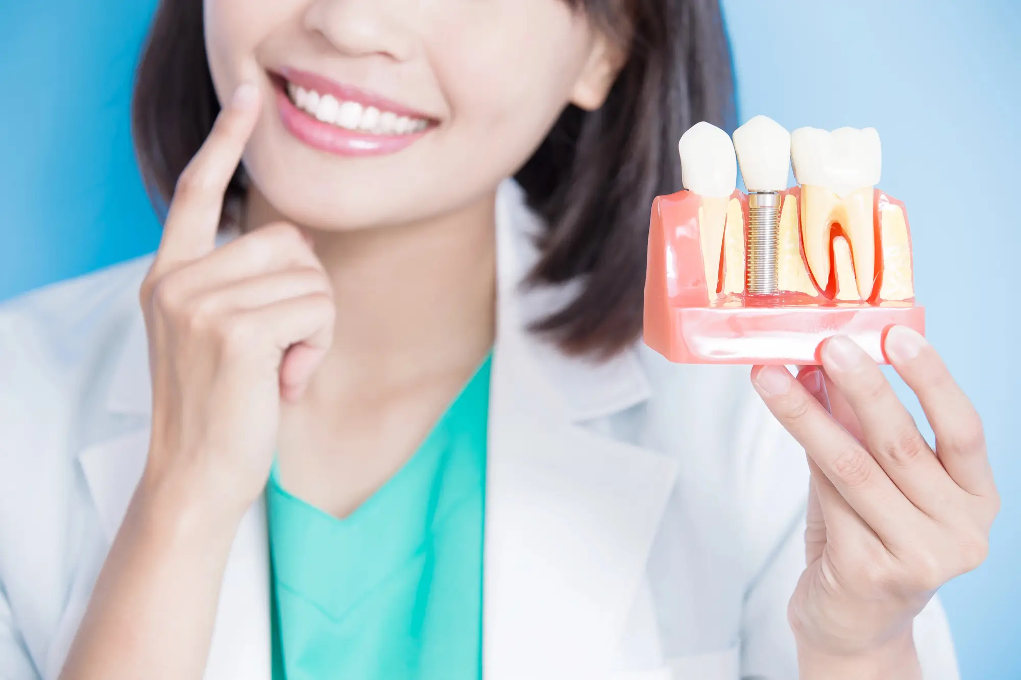 Implant Tooth Model for Dental Bridges in Riverview, MI
