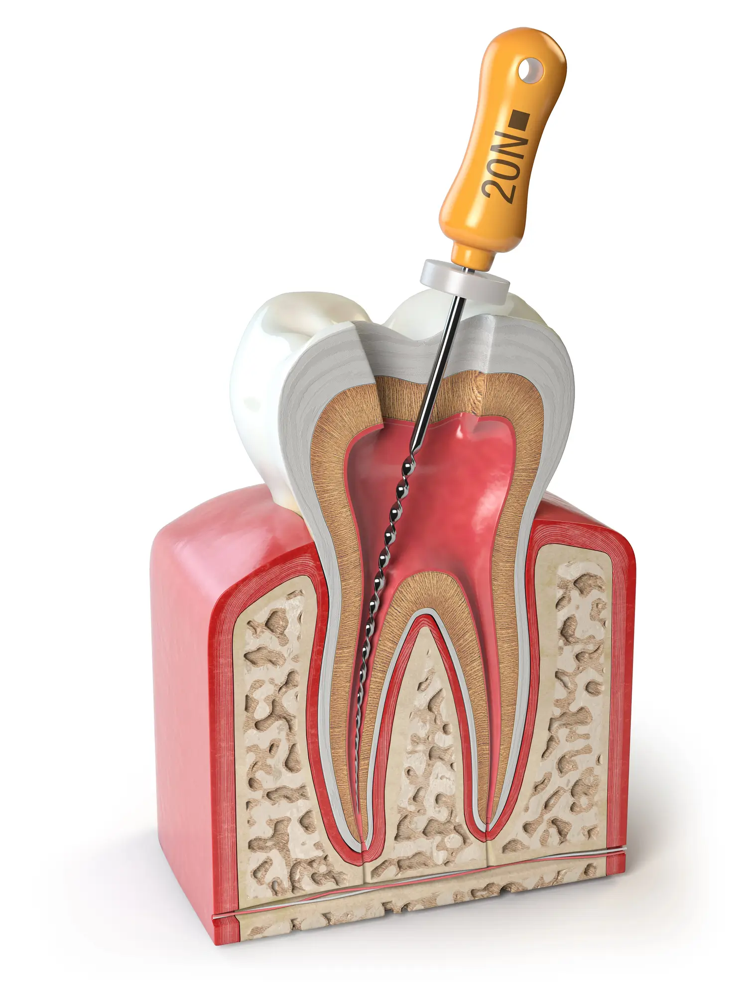 Endodontic File for Root Canal Treatments in Riverview, MI